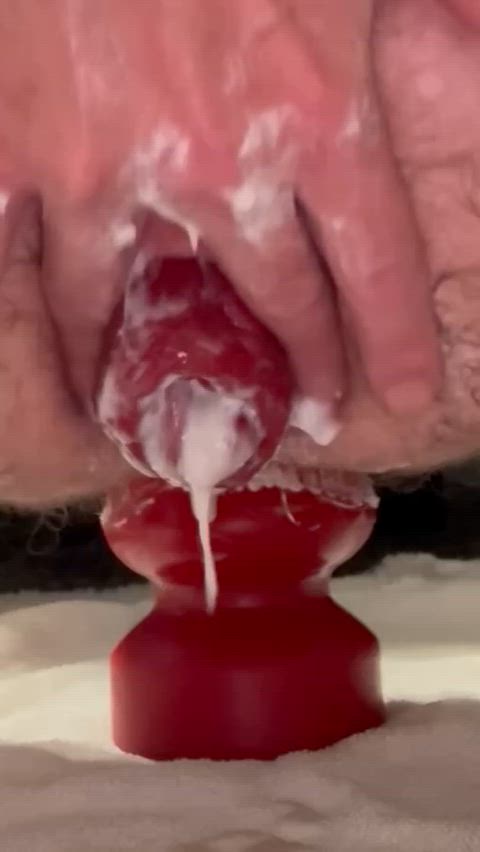 Gape Gaping Prolapse